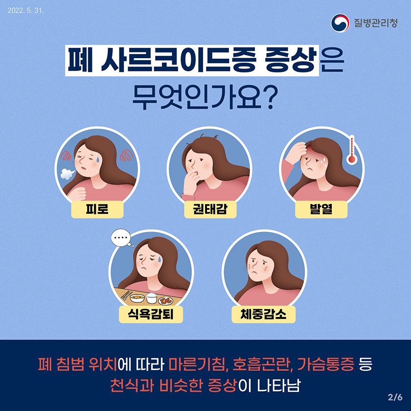 폐 사르코이드증 증상은 무엇인가요? 피로, 권태감, 발열, 식욕감퇴, 체중감소 폐 침범 위치에 따라 마른기침, 호흡곤란, 가슴통증 등 천식과 비슷한 증상이 나타남 2/6